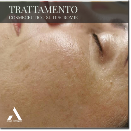 trattamento macchie prima consulenza trattamento macchie prima consulenza
