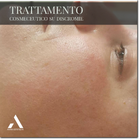 trattamento macchie il risultato trattamento macchie il risultato