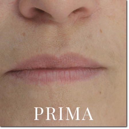 trucco permanente labbra prima trucco permanente labbra prima
